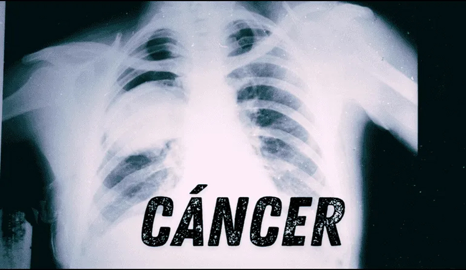 RIESGO DE TUMOR